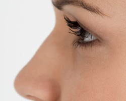 Rinoplastia - Cirugía estética